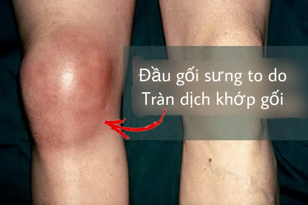 Tiền mất tật mang khi điều trị bệnh lý khớp tại các cơ sở không chuyên