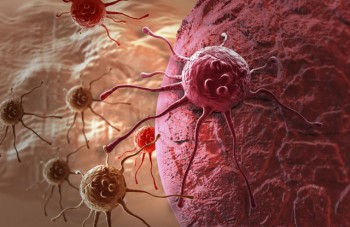 Tìm ra cách ngăn tế bào ung thư di căn