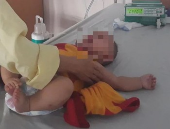 Quảng Bình: Bé gái 6 tháng tuổi phải cắt bỏ buồng trứng vì gia đình không đưa đi viện sớm