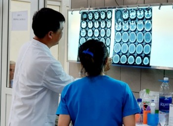 Ca đầu tiên ở Việt Nam ghi nhận ngộ độc ma túy gây ra xuất huyết não