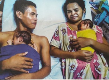 4 triệu trẻ sơ sinh được cứu sống bằng “Cái ôm đầu tiên”