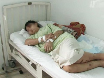 Khởi tố bắt giam kẻ tra tấn thai phụ khiến thai nhi tử vong