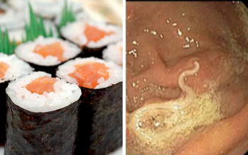 Cảnh giác với nhiễm giun chết người từ món sushi