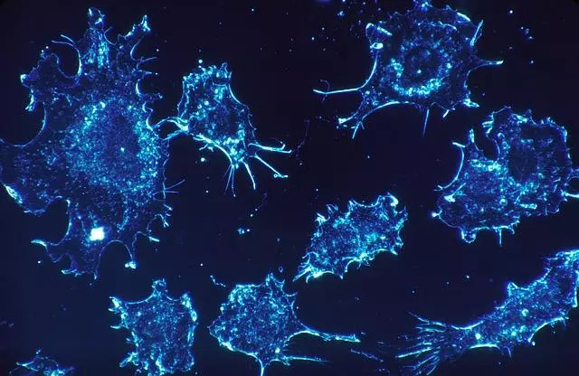 Cách điều trị ung thư mới có thể phá hủy khối u tốt hơn hóa trị và xạ trị