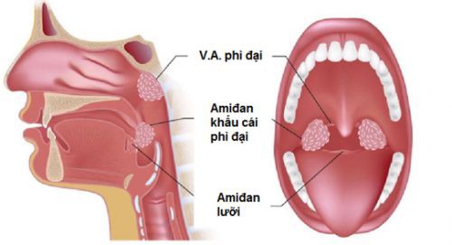 co nen cat amidan khong