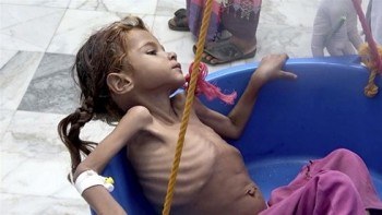 Chiến sự khốc liệt đẩy Yemen tới bờ vực thảm họa nhân đạo