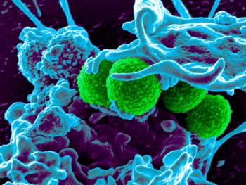 Đã tìm ra cách tiêu diệt vi khuẩn kháng thuốc chưa từng biết tới