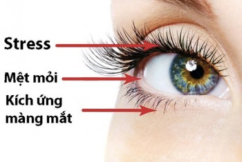 7 cách trị chứng giật mắt