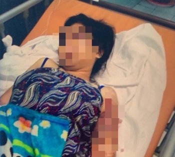 Tình tiết man rợ vụ cô gái 18 tuổi bị tra tấn đến sẩy thai ở Bình Chánh